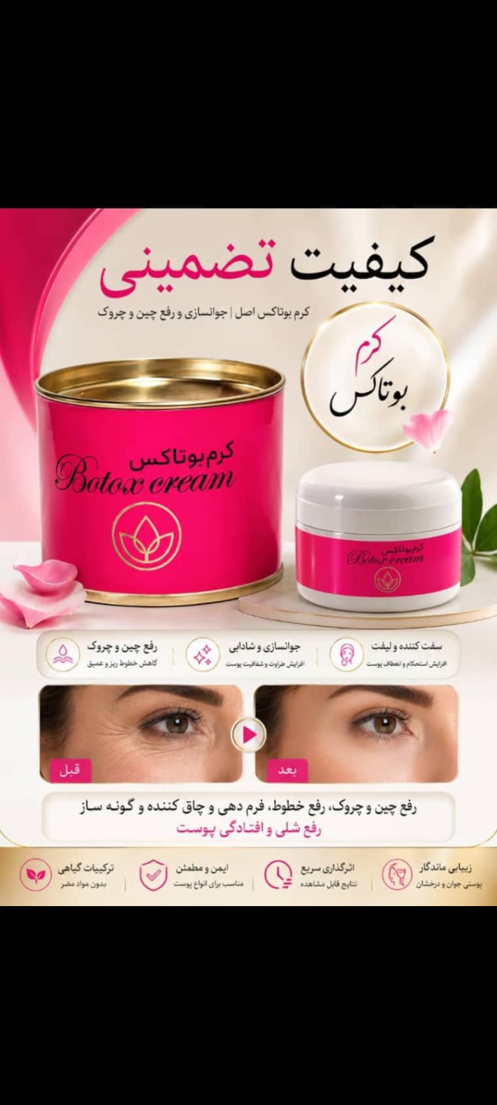 کرم بوتاکس حجم دهنده گونه - استوک