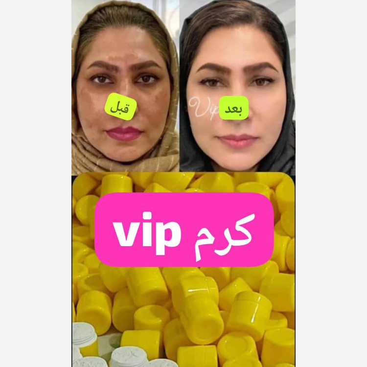 کرم اماراتی روشن کننده ی قوی